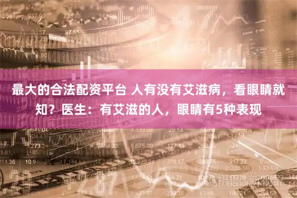 最大的合法配资平台 人有没有艾滋病，看眼睛就知？医生：有艾滋的人，眼睛有5种表现